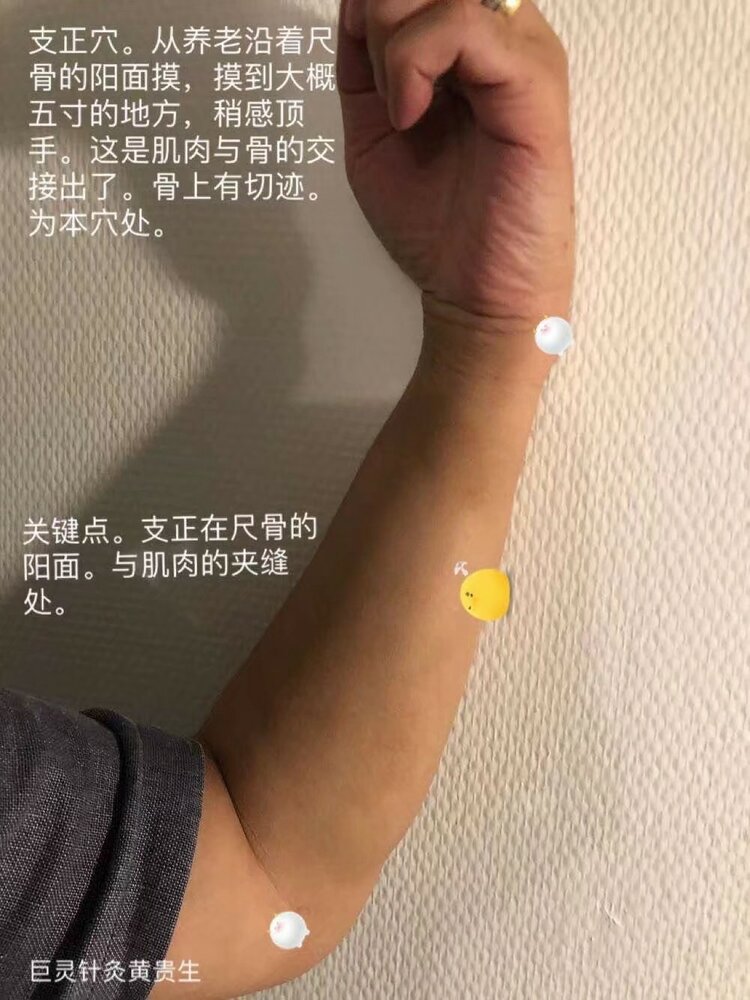 周颖医生～古派针灸师