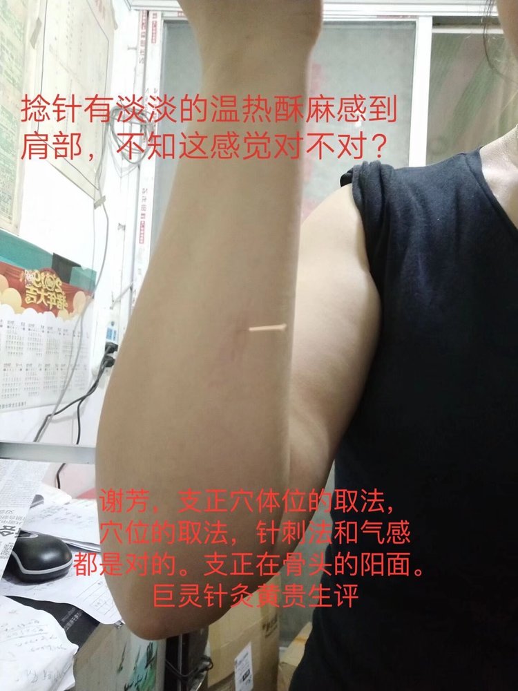 周颖医生～古派针灸师