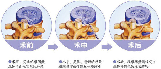 朱梓升